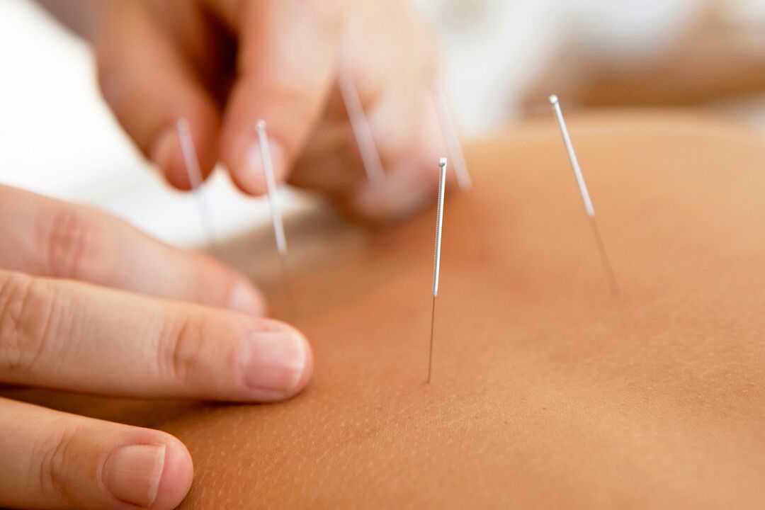akupunktur for å øke styrken