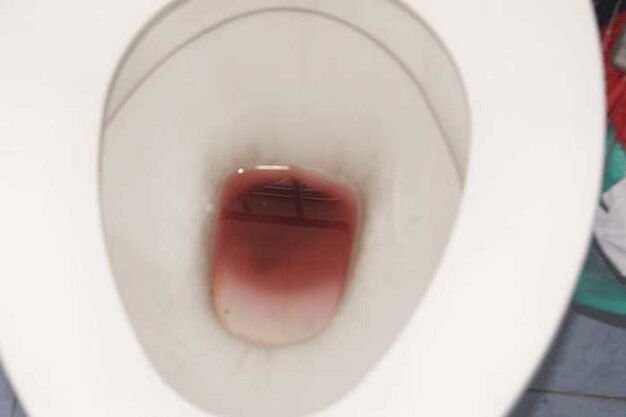 spotting hos menn når de er spente